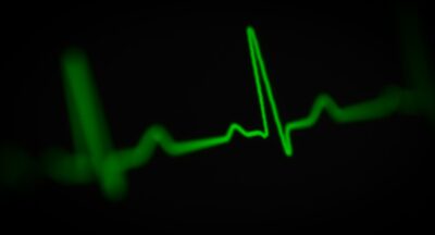 Czy holter wykryje nerwicę? – Na co wskazuje monitorowanie serca?